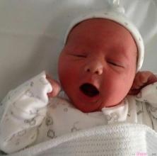 【预防】预防婴儿红胎记，家长该做些什么(图1)